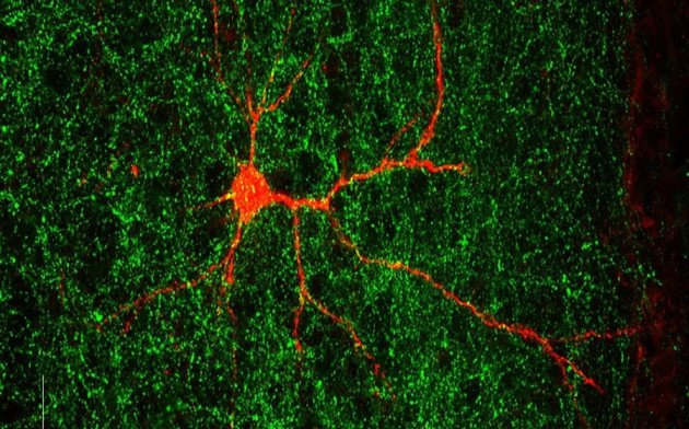 Neuron: исследователи обнаружили связанный с аутизмом ген, который формирует нервные связи