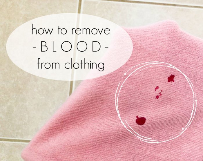 Как удалить кровь с одежды