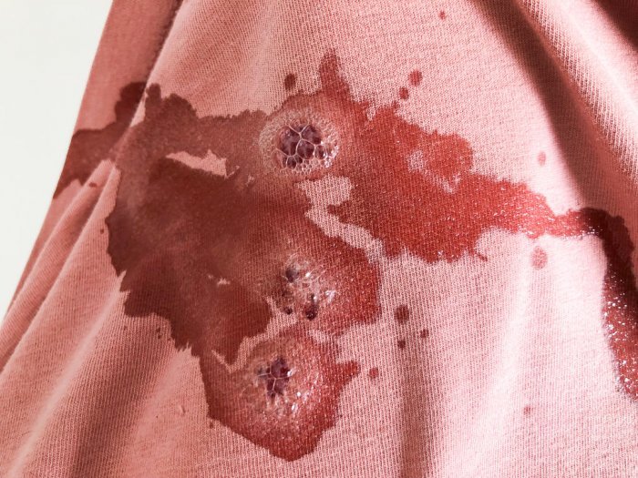 Как удалить кровь с одежды
