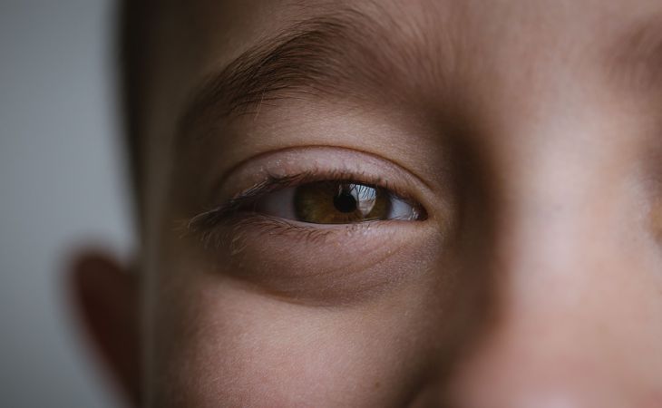 4 эффективных способа борьбы с усталостью глаз